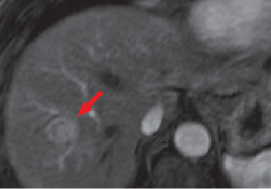 (d) Arterial phase