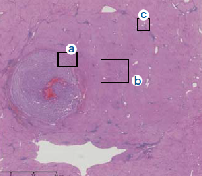 Histopathology findings (1)