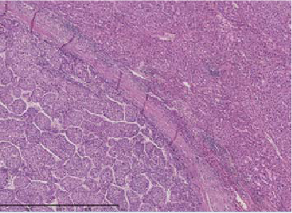 (2) Magnification of “a”