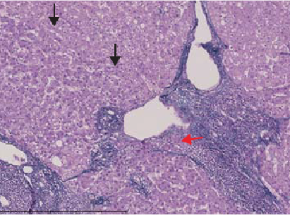 (e) Hepatobiliary phase