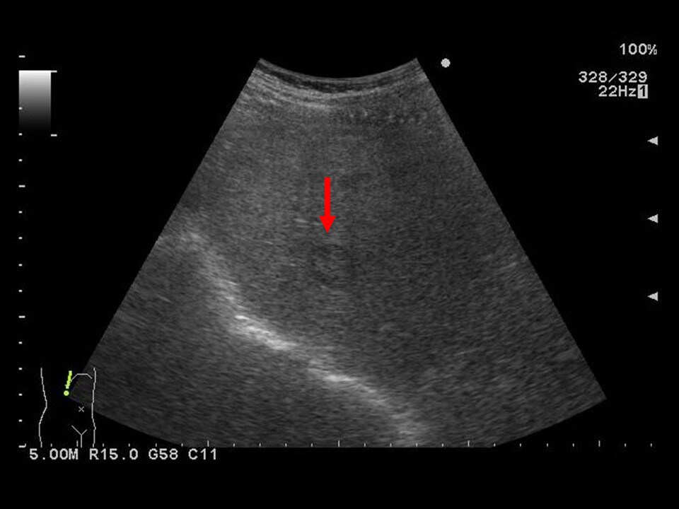 Fig. 1. Abdominal ultrasonography (1)