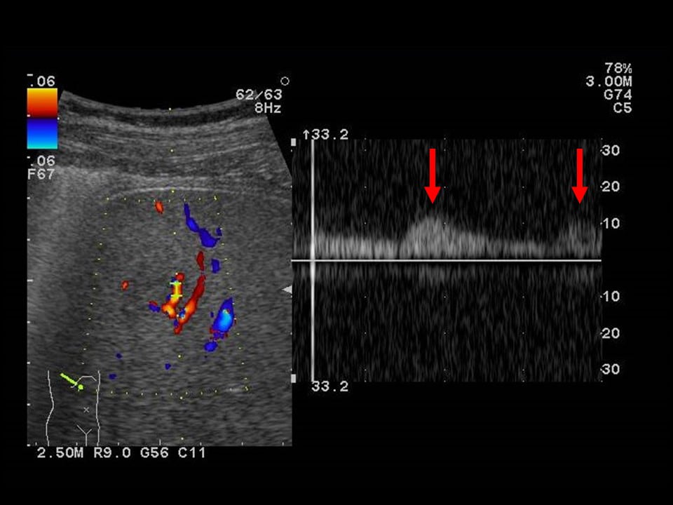 Fig. 2. Abdominal ultrasonography (2)