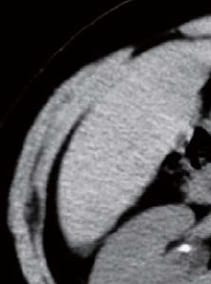 Simple CT