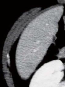 Contrast CT equilibrium phase