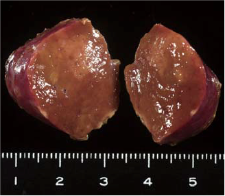 Findings with macroscopic observation