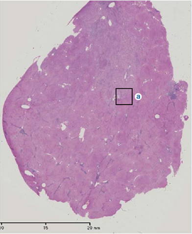 (i) Histopathology findings