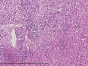 (ii) Magnification of “a”