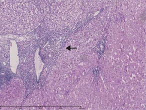 (iii) Magnification of “a” (stained with Victoria blue)