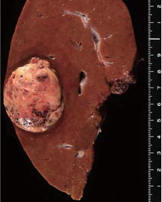 Findings with macroscopic observation