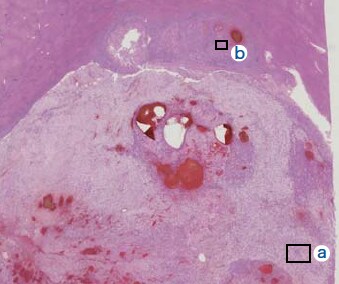 (i) Histopathology findings