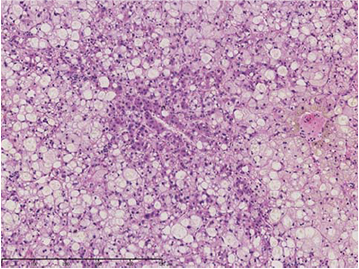 (ii) Magnification of “a”