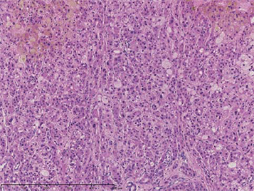 (iii) Magnification of “b”