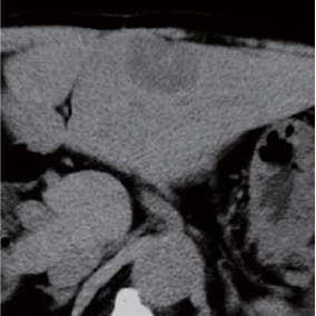 Simple CT