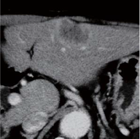 Contrast CT equilibrium phase