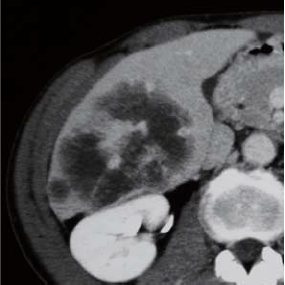 Contrast CT equilibrium phase