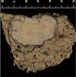 Findings with macroscopic observation