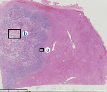 (i) Histopathology findings