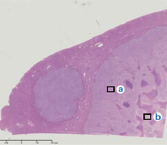 (i) Histopathology findings