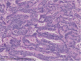 (4) Magnification of “d”