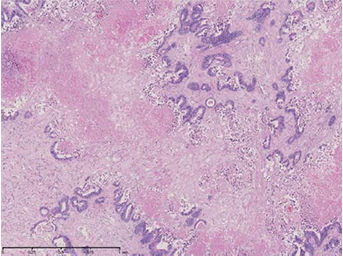 (iii) Magnification of “b”