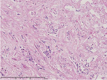 (iii) Magnification of “b”
