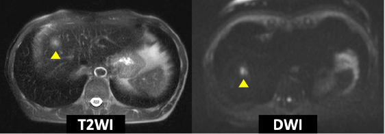 Fig. 3. EOB-MRI