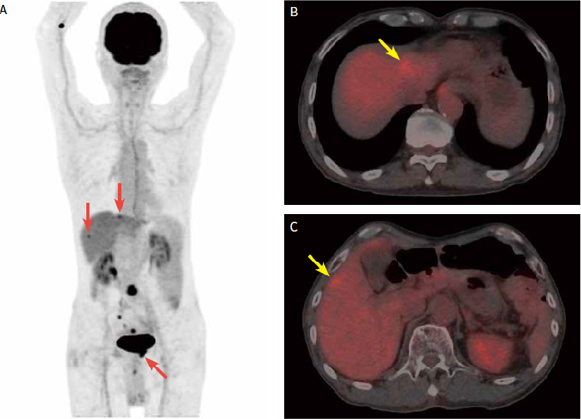 Fig. 1. PET-CT images