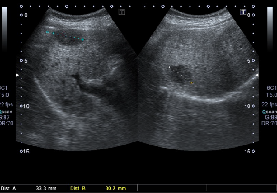 Figure 1. Ultrasound image