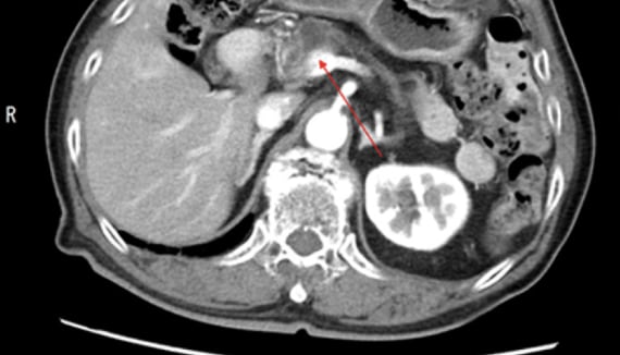 Imaging Quiz for Hepatologist