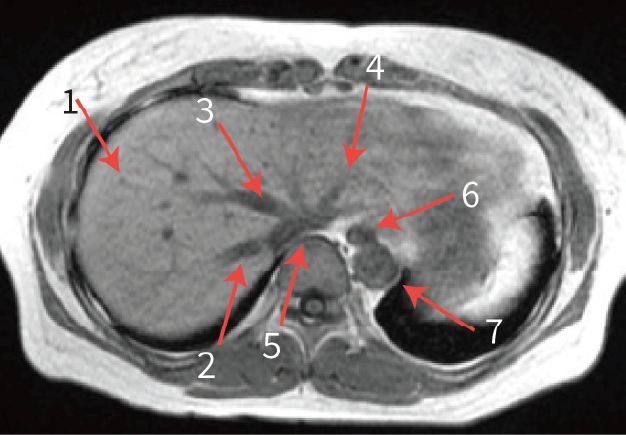 Fig. 7 Axial images