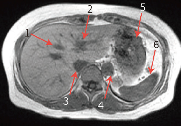Fig. 7 Axial images