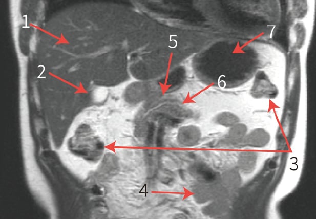 Fig. 8 Coronal images