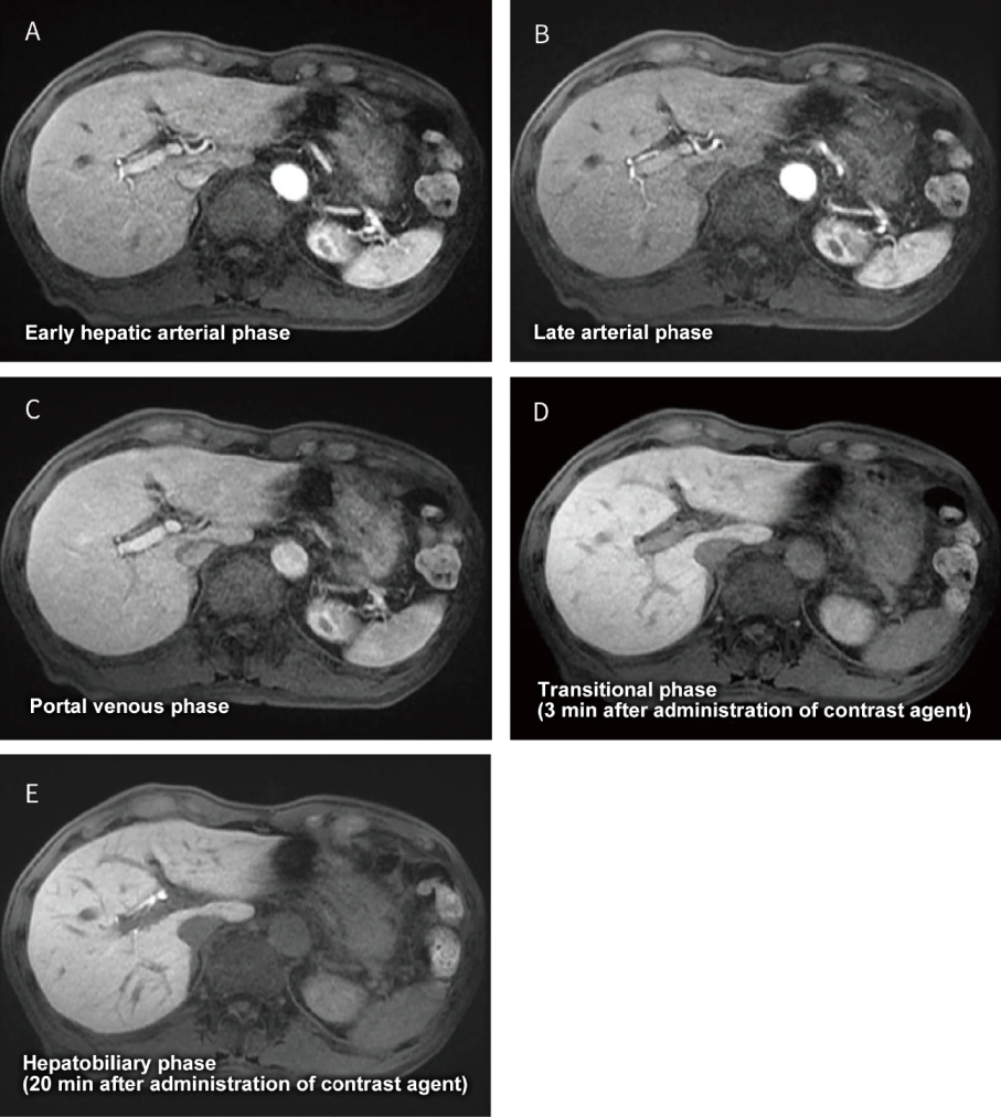 Fig. 17 Images from each phase of dynamic contrast-enhanced imaging