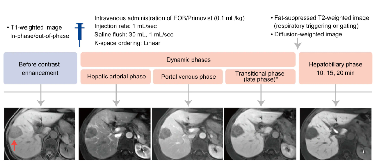 Fig. 18 A common EOB-MRI examination workflow