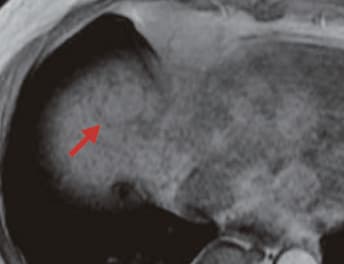 S8: T1-weighted image (c)