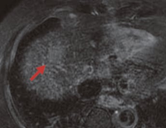 S8: T2-weighted image (d) 