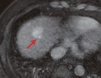 S8: Arterial phase (e)
