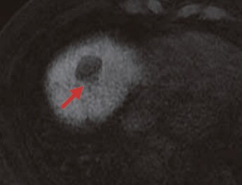 S8: Hepatobiliary phase (g)