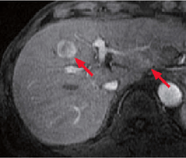 k) Arterial phase