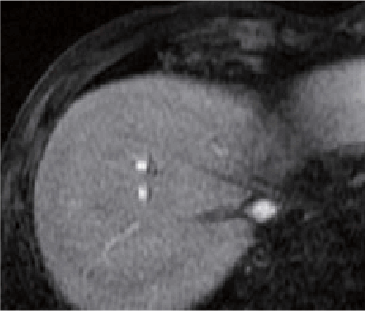 q) Arterial phase