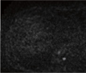 p) Diffusion-weighted image (b value = 1000 s/mm2)