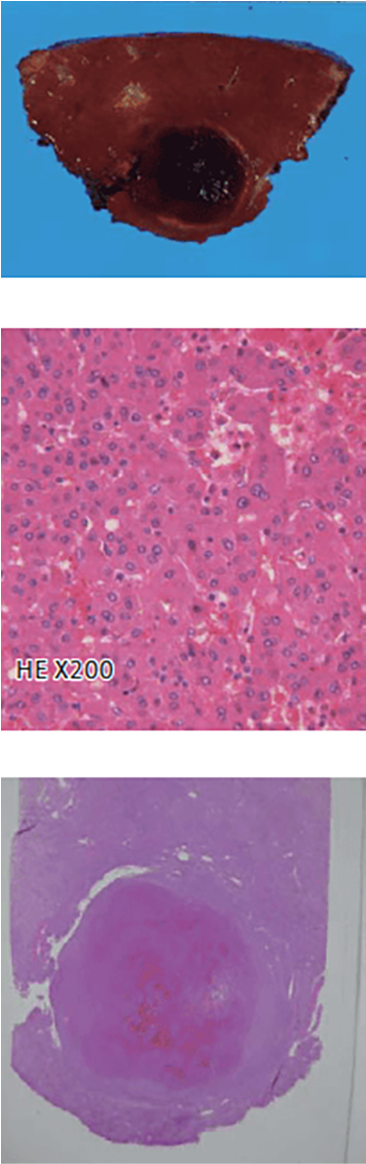 s) Liver S4