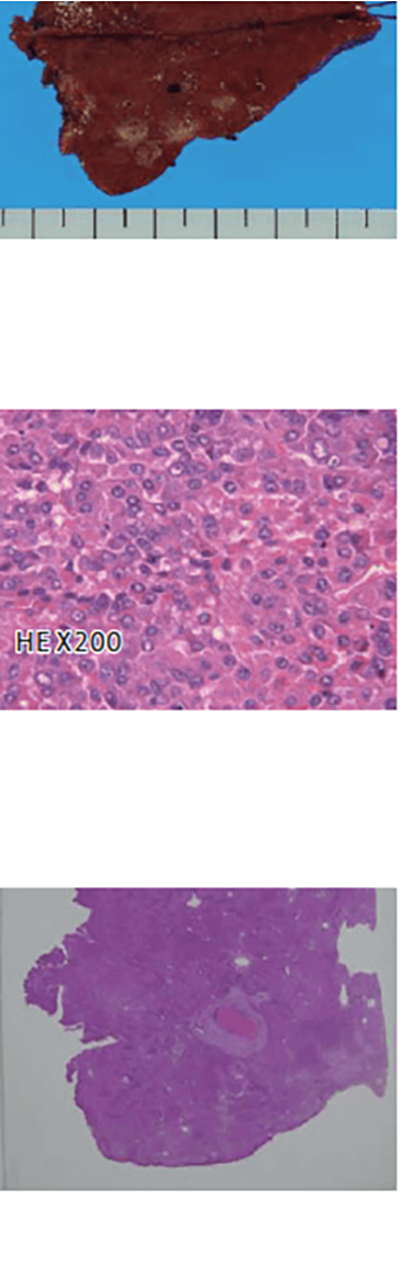 t) Liver S2