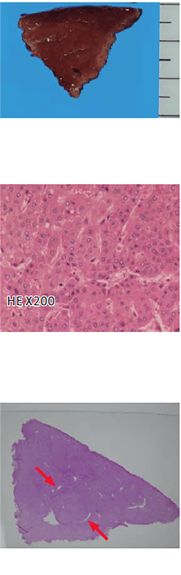 u) Liver S4/8