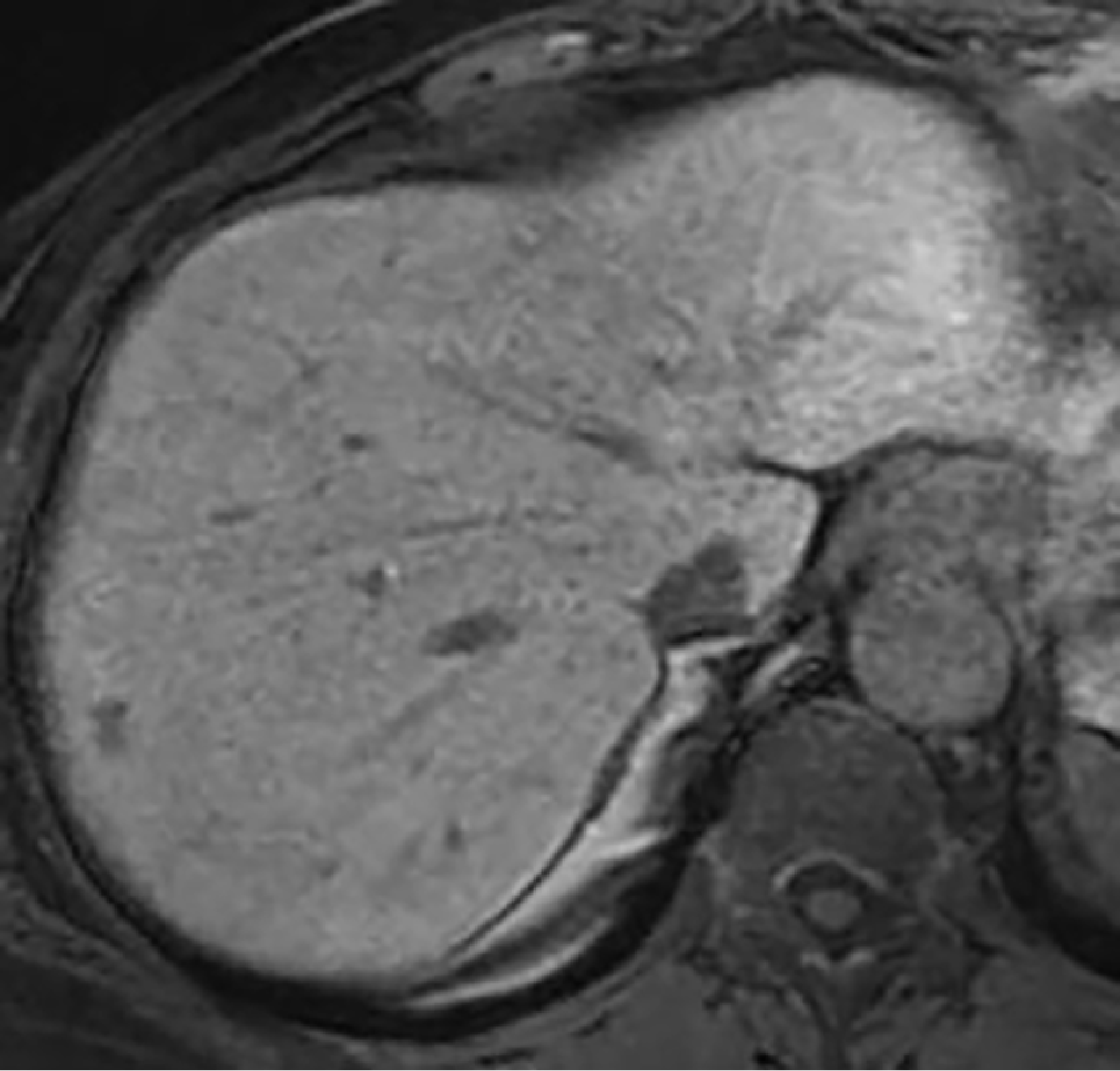 Fig. 4. EOB-MRI in January of Year 202X + 1