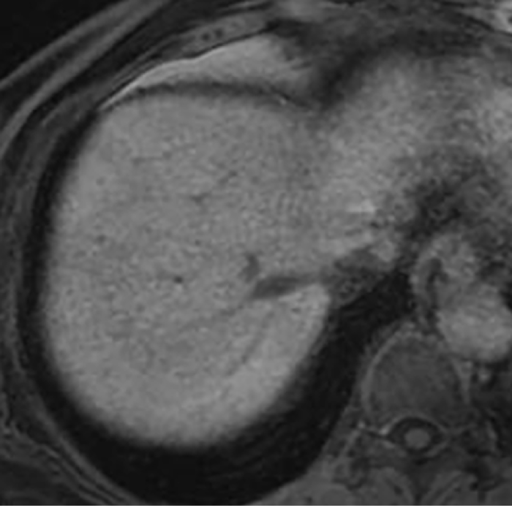 Fig. 5. EOB-MRI in January of Year 202X + 1