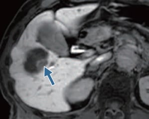 Hepatobiliary phase (h)