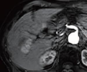 Arterial-dominant phase (j)