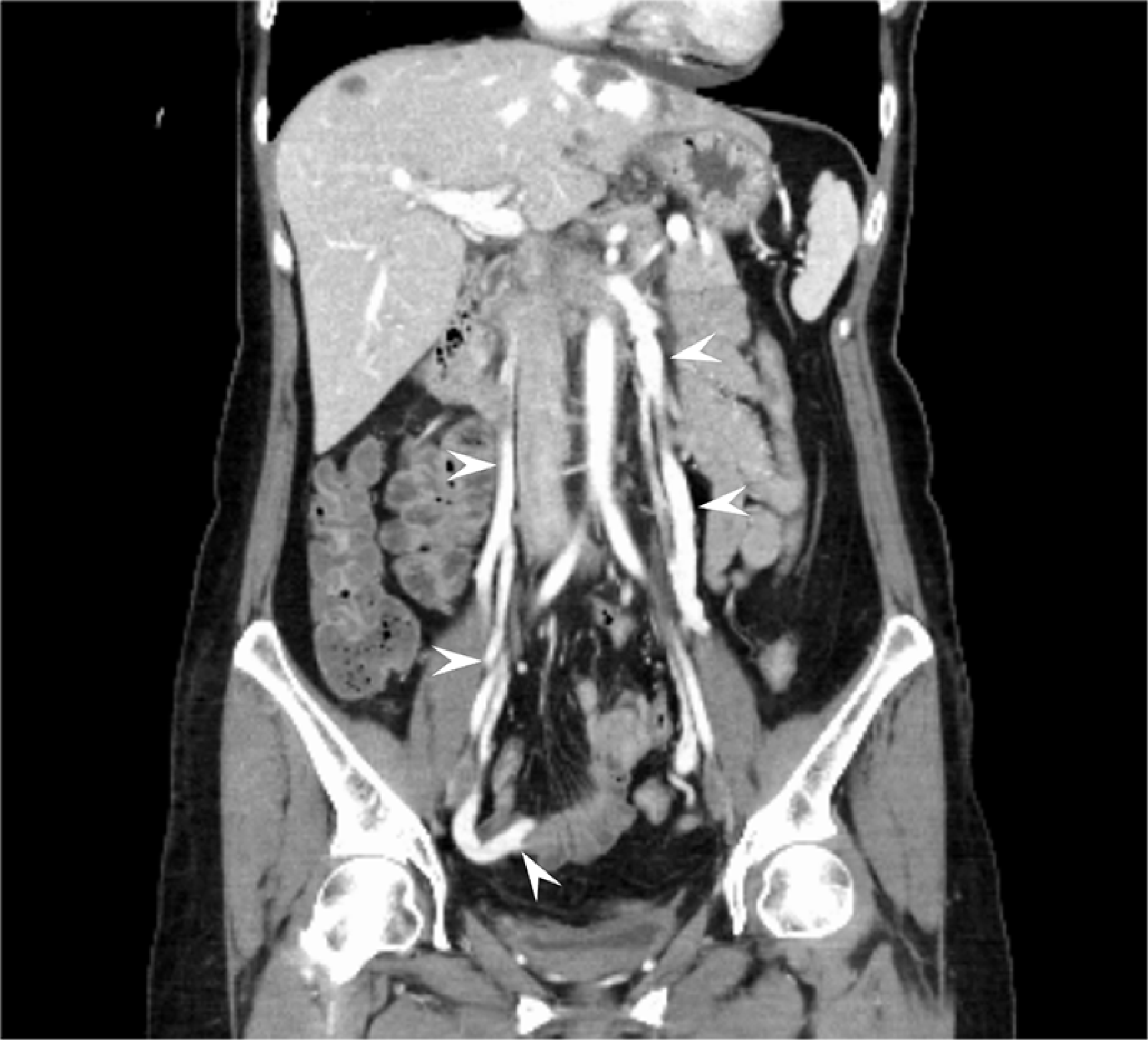 Figs. 5, 6. Coronal reconstruction images
