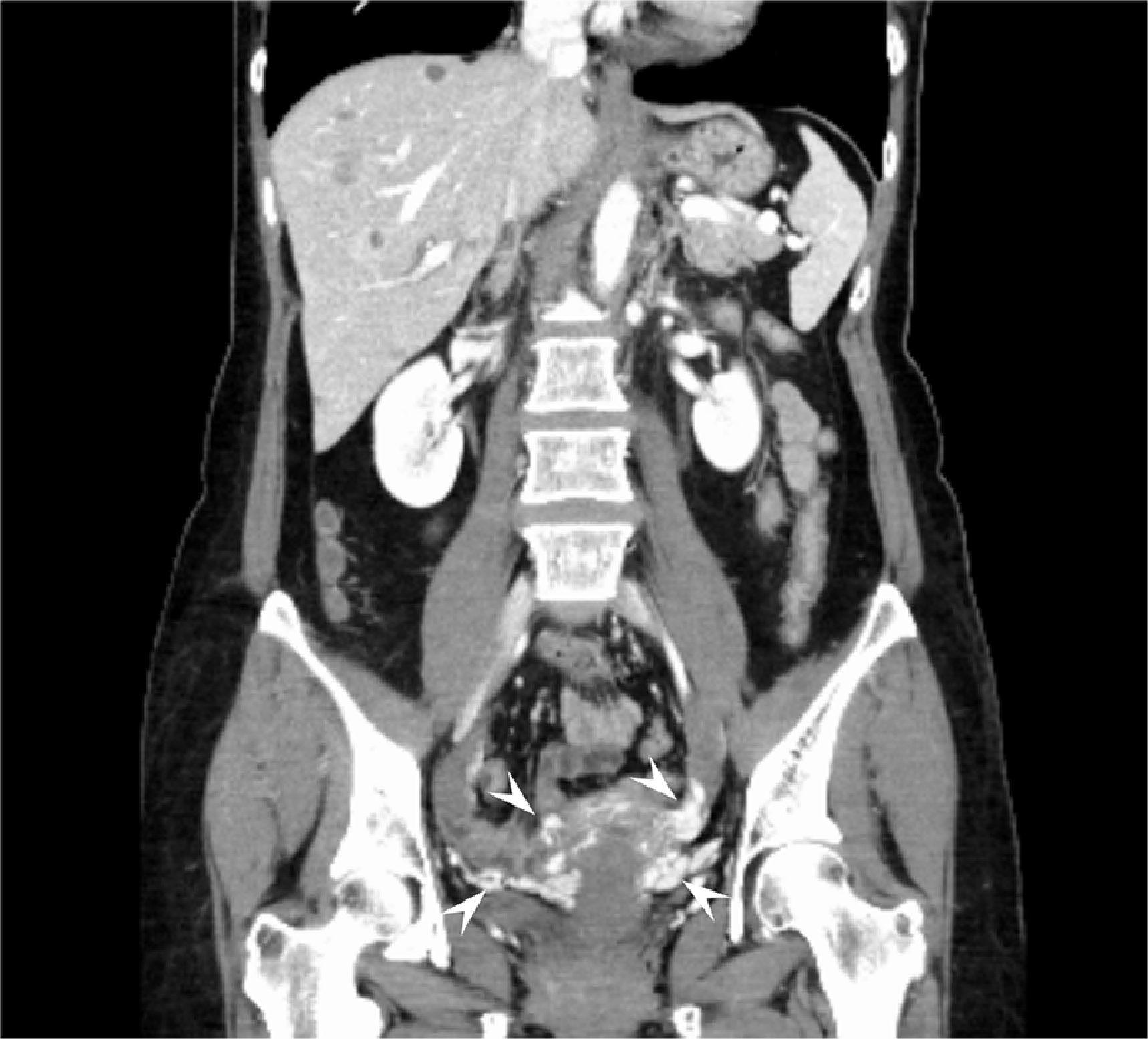 Figs. 5, 6. Coronal reconstruction images